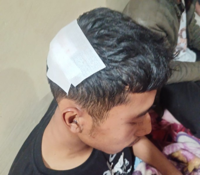 Pulang Dari Cafe, Sepasang Kekasih Di Merek Dibegal Menggunakan Pistol, Pelaku Naik Mobil L300 Pulang Dari Cafe, Sepasang Kekasih Di Merek Dibegal Menggunakan Pistol, Pelaku Naik Mobil L300