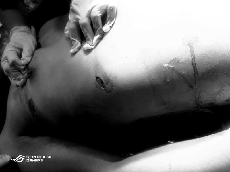 Luka Tusuk Enam Liang, Robi Perangin Angin Tewas Saat Mengunjungi Karoke Bravo